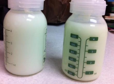 Conservation du lait humain : quelques études